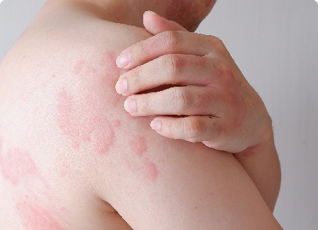 skin_article